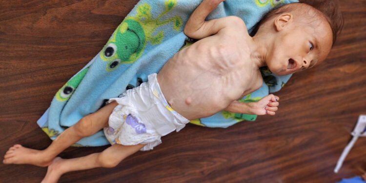 Middle East – Oxfam Accuses World Leaders of Inaction as Gaza Faces Starvation Crisis Under Israeli Blockade